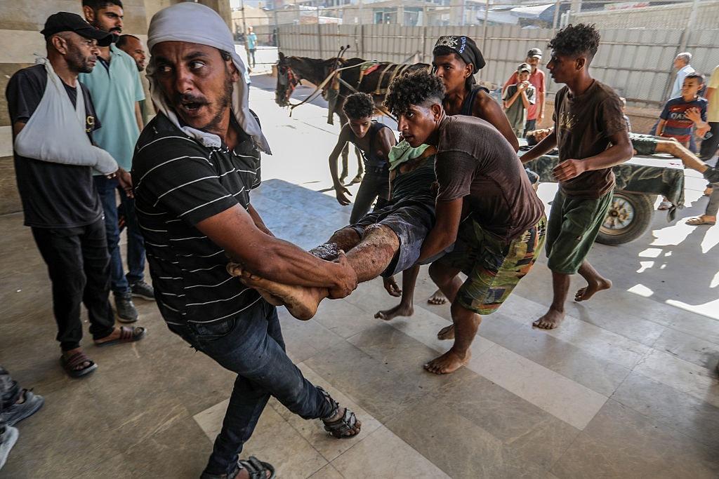 Medici.Le ferite ferite dai civili del gas sono particolarmente difficili